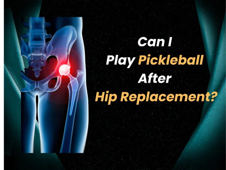 Can I Play Pickleball After Hip Replacement?